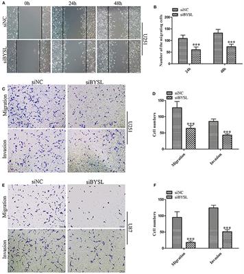 BYSL Promotes Glioblastoma Cell Migration, Invasion, and Mesenchymal Transition Through the GSK-3β/β-Catenin Signaling Pathway